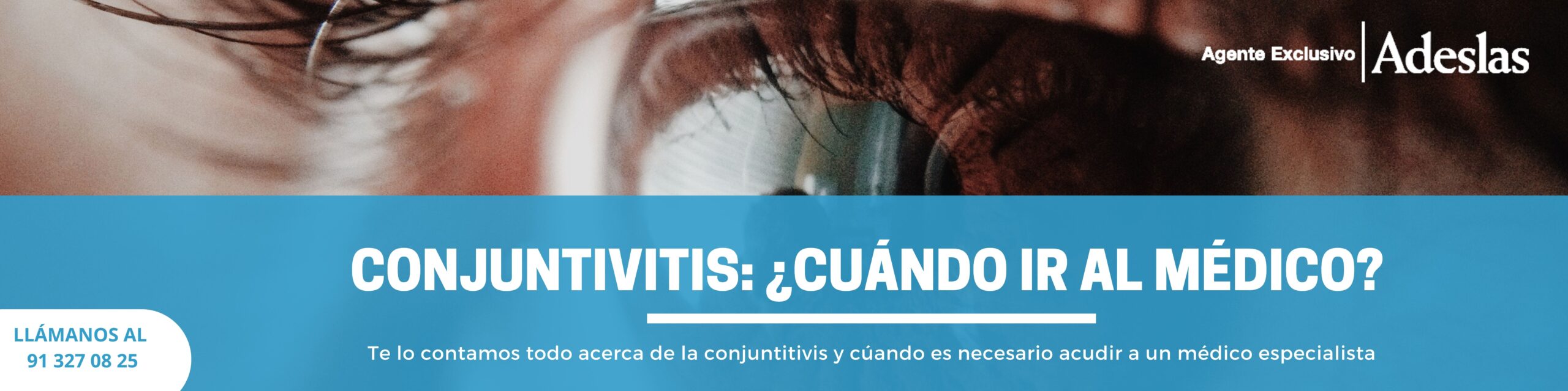 conjuntivitis